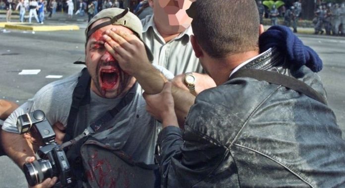 STF decide que Estado de SP deve indenizar Alex Silveira